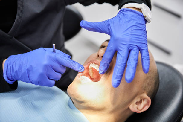 Best Emergency Wisdom Tooth Extraction in Jersey City, NJ